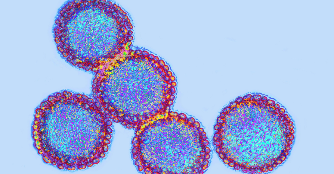 Flu: Facts about seasonal influenza and bird flu