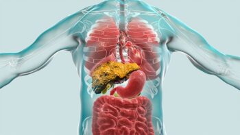 Preemptive TIPS Promising for Fundal Variceal Bleeding