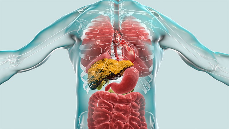 Preemptive TIPS Promising for Fundal Variceal Bleeding