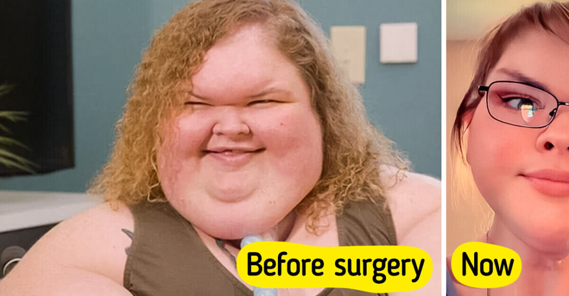 “Proud of You,” 1000-lb Sisters Star’s Incredible Before and After Skin Removal Surgery