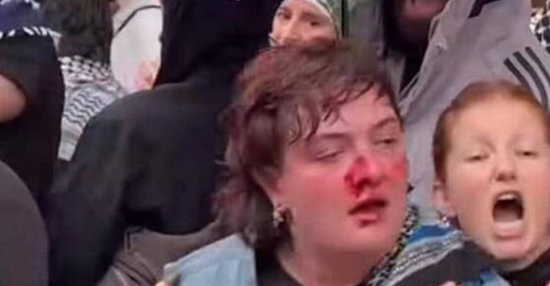 Irish protestor hospitalised after being punched by police in Berlin
