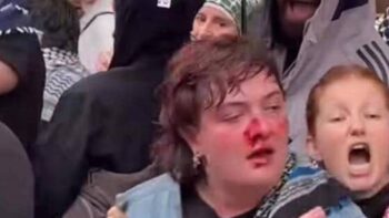 Irish protestor hospitalised after being punched by police in Berlin